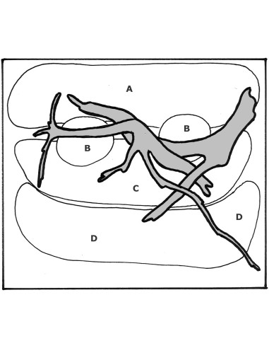 Tropica Lot Débutant - Layout 66 (48L)